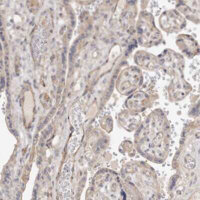 Immunohistochemistry-Paraffin: ADAMTS9 Antibody [NBP1-82915] - Staining of human placenta shows moderate cytoplasmic positivity in trophoblastic cells.