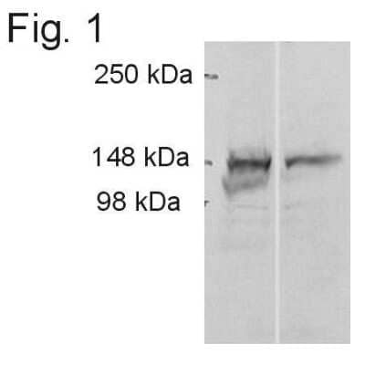 Western Blot: ADAMTS9 Antibody [NB100-74345] - Cell lysates transfected with ADAMTS9. Lane 1: TS9 transfected HEK-293 cell lysate. Lane 2: Untreated cell lysate.