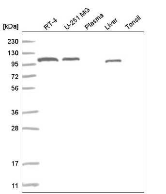 Western Blot: ADAMTS9 Antibody [NBP2-55347] - Western blot analysis in human cell line RT-4, human cell line U-251 MG, human plasma, human liver tissue and human tonsil tissue.