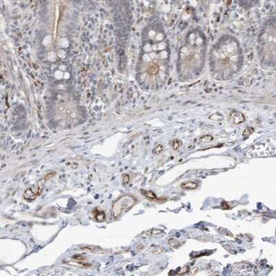 Immunohistochemistry ADAMTSL3 Antibody - BSA Free