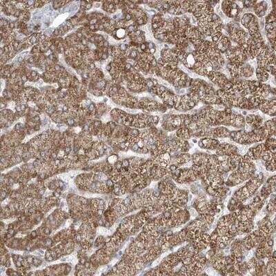 Immunohistochemistry-Paraffin ADAMTSL3 Antibody - BSA Free