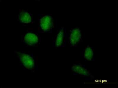 Immunocytochemistry/Immunofluorescence: ADAMTSL4 Antibody [H00054507-B01P] - Analysis of purified antibody to ADAMTSL4 on HeLa cell. (antibody concentration 10 ug/ml)