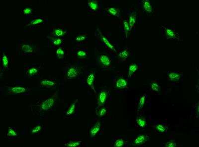 Immunocytochemistry/Immunofluorescence: ADAMTSL4 Antibody [NBP3-05785] -  Staining of ADAMTSL4 in HeLa cells. Cells were fixed with 4% PFA, permeabilzed with 0.3% Triton X-100 in PBS,blocked with 10% serum, and incubated with rabbit anti-Human ADAMTSL4 polyclonal antibody (dilution ratio 1:200) at 4? overnight. Then cells were stained with the Alexa Fluor®488-conjugated Goat Anti-rabbit IgG secondary antibody (green). Positive staining was localized to Nucleus.