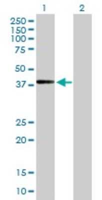 Western Blot: ADAMTSL4 Antibody [H00054507-B01P] - Analysis of ADAMTSL4 expression in transfected 293T cell line by ADAMTSL4 polyclonal antibody.  Lane 1: ADAMTSL4 transfected lysate(46.64 KDa). Lane 2: Non-transfected lysate.