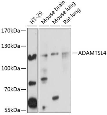 Western Blot: ADAMTSL4 Antibody [NBP2-92647] - Analysis of extracts of various cell lines, using ADAMTSL4 at 1:1000 dilution.Secondary antibody: HRP Goat Anti-Rabbit IgG (H+L) at 1:10000 dilution.Lysates/proteins: 25ug per lane.Blocking buffer: 3% nonfat dry milk in TBST.Detection: ECL Basic Kit .Exposure time: 10s.