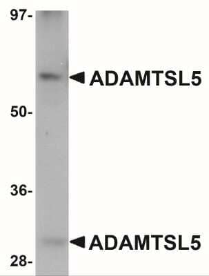 Western Blot: ADAMTSL5 Antibody [NBP2-41120] - Western blot analysis of ADAMTSL5 in human skeletal muscle tissue lysate with ADAMTSL5 antibody at 1 ug/mL.