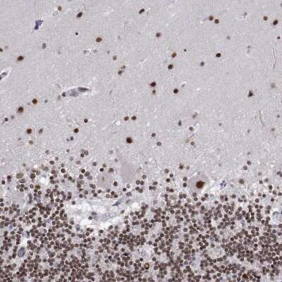 Immunohistochemistry-Paraffin ADAR Antibody