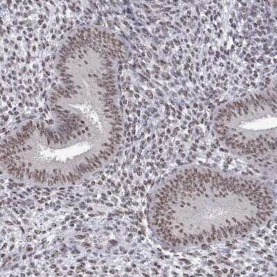 Immunohistochemistry-Paraffin ADAR Antibody