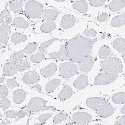Immunohistochemistry-Paraffin ADAR Antibody