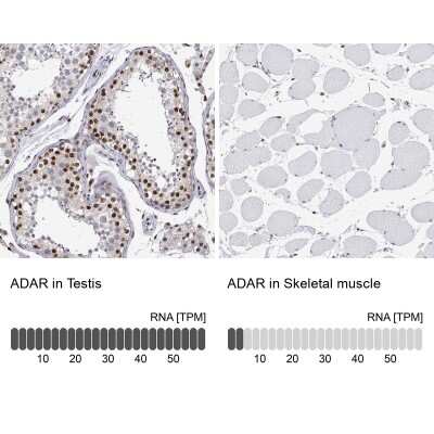 Immunohistochemistry-Paraffin: ADAR Antibody [NBP1-90242] - Staining in human testis and skeletal muscle tissues using NBP1-90242 antibody. Corresponding ADAR RNA-seq data are presented for the same tissues.