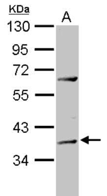 Western Blot: ADAT1 Antibody [NBP2-15288] - Sample (30 ug of whole cell lysate) A: MCF-7 10% SDS PAGE, antibody diluted at 1:3000.