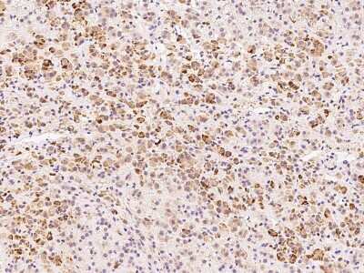 Immunohistochemistry-Paraffin: ADAT3 Antibody [NBP2-99169] - Immunochemical staining of human ADAT3 in human adrenal gland with rabbit polyclonal antibody at 1:1500 dilution, formalin-fixed paraffin embedded sections.