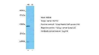 Western Blot: ADAT3 Antibody [NBP2-84394] - Host: Rabbit. Target: ADAT3. Positive control (+): HepG2 (HG). Negative control (-): Human lung (LU). Antibody concentration: 1ug/ml