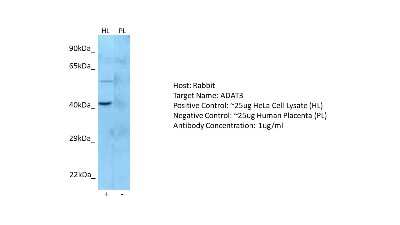 Western Blot: ADAT3 Antibody [NBP2-84395] - Host: Rabbit. Target: ADAT3. Positive control (+): HeLa Cell Lysate (HL). Negative control (-): Human Placenta (PL). Antibody concentration: 1ug/ml