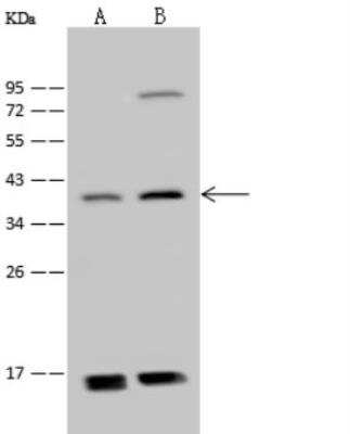 Western Blot: ADAT3 Antibody [NBP2-99169] - Anti-ADAT3 rabbit polyclonal antibody at 1:500 dilution. Lane A: 293T Whole Cell Lysate Lane B: Jurkat Whole Cell Lysate Lysates/proteins at 30 ug per lane. Secondary Goat Anti-Rabbit IgG (H+L)/HRP at 1/10000 dilution. Developed using the ECL technique. Performed under reducing conditions. Predicted band size: 38 kDa. Observed band size: 38 kDa