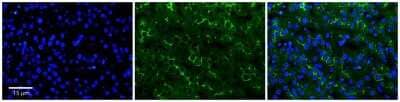 Immunohistochemistry-Paraffin: ADCK2 Antibody [NBP2-84396] - Rabbit Anti-ADCK2 Antibody. Formalin Fixed Paraffin Embedded Tissue: Human Adult Liver. Observed Staining: Membrane in bile canaliculi, strong signal, wide tissue distribution. Primary Antibody Concentration: 1:100. Secondary Antibody: donkey anti-rabbit