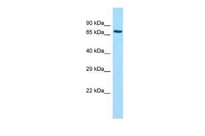 Western Blot: ADCK2 Antibody [NBP2-84396] - Host: Rabbit. Target Name: ADCK2. Sample Type: Jurkat Whole Cell lysates. Antibody Dilution: 1.0ug/mlADCK2 is supported by BioGPS gene expression data to be expressed in Jurkat