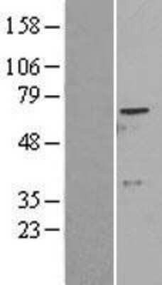 Western Blot: ADCK2 Overexpression Lysate (Adult Normal) [NBL1-07325] Left-Empty vector transfected control cell lysate (HEK293 cell lysate); Right -Over-expression Lysate for ADCK2.