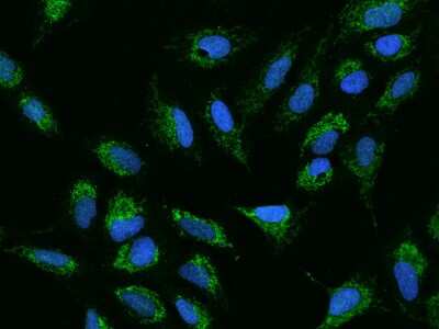 Immunocytochemistry/Immunofluorescence: ADCK4 Antibody [NBP2-98583] - Immunofluorescence staining of ADCK4 in U2OS cells. Cells were fixed with 4% PFA, permeabilzed with 0.1% Triton X-100 in PBS, blocked with 10% serum, and incubated with rabbit anti-Human ADCK4 polyclonal antibody (dilution ratio 1:200) at 4C overnight. Then cells were stained with the Alexa Fluor(R)488-conjugated Goat Anti-rabbit IgG Secondary antibody (green) and counterstained with DAPI (blue).Positive staining was localized to Cytoplasm.