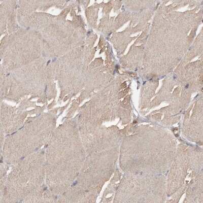 Immunohistochemistry-Paraffin: ADCK4 Antibody [NBP1-85508] - Staining of human skeletal muscle shows low expression as expected.