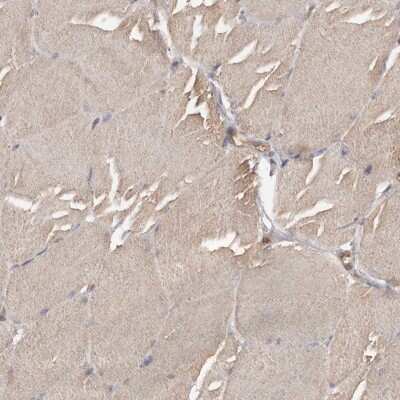 Immunohistochemistry-Paraffin: ADCK4 Antibody [NBP1-85508] - Staining of human skeletal muscle shows low expression as expected.