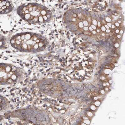 Immunohistochemistry-Paraffin: ADCK4 Antibody [NBP1-85509] - Staining of human colon shows moderate cytoplasmic positivity in glandular cells.