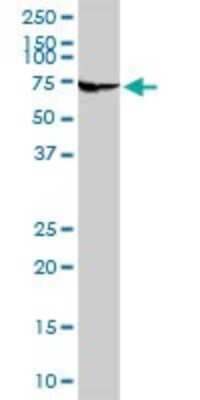 Western Blot: ADCK4 Antibody [H00079934-D01P] - Analysis of ADCK4 expression in A-431.