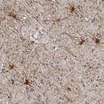 Immunohistochemistry-Paraffin ADCK5 Antibody - BSA Free