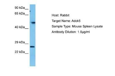 Western Blot ADCK5 Antibody - BSA Free