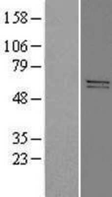 Western Blot: ADCK5 Overexpression Lysate (Adult Normal) [NBP2-05099] Left-Empty vector transfected control cell lysate (HEK293 cell lysate); Right -Over-expression Lysate for ADCK5.
