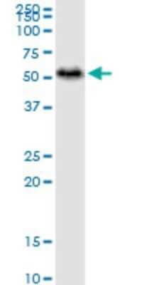 Western Blot: ADE2 Antibody (4F4) [H00010606-M01] - PAICS monoclonal antibody (M01), clone 4F4. Analysis of PAICS expression in human placenta.