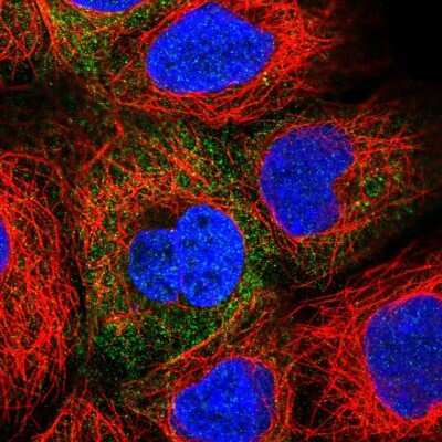 <b>Independent Antibodies Validation. </b>Immunocytochemistry/Immunofluorescence: ADE2 Antibody [NBP2-58966] - Staining of human cell line HEK 293 shows localization to cytosol.