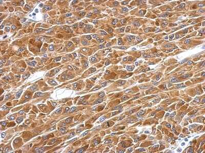 Immunohistochemistry-Paraffin: ADE2 Antibody [NBP2-15289] - U87 xenograft, using PAICS  antibody at 1:500 dilution. Antigen Retrieval: Trilogy™ (EDTA based, pH 8.0) buffer, 15min.