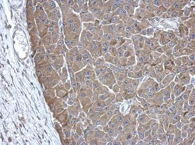 Immunohistochemistry-Paraffin: ADE2 Antibody [NBP2-15290] - Paraffin-embedded HBL435 xenograft, using antibody at 1:500 dilution.