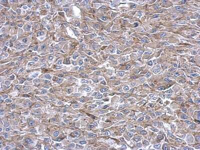 Immunohistochemistry-Paraffin: ADE2 Antibody [NBP2-15290] - Paraffin-embedded RT2 xenograft, using antibody at 1:500 dilution.