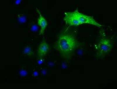 Immunocytochemistry/Immunofluorescence: ADE2 Antibody (OTI1B4) - Azide and BSA Free [NBP2-71610] - staining of COS7 cells transiently transfected by pCMV6-ENTRY PAICS.