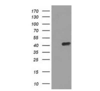 Western Blot: ADE2 Antibody (OTI1B4) - Azide and BSA Free [NBP2-71610] - HEK293T cells were transfected with the pCMV6-ENTRY control (Left lane) or pCMV6-ENTRY PAICS ( Right lane) cDNA for 48 hrs and lysed. Equivalent amounts of cell lysates (5 ug per lane) were separated by SDS-PAGE and immunoblotted with anti-PAICS. Positive lysates.