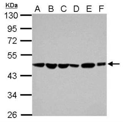 Western Blot: ADE2 Antibody [NBP2-15289] - Sample (30 ug of whole cell lysate) A: Jurkat B: Raji C: K562 D: THP-1 E: HL-60 F: NCI-H929 10% SDS PAGE; antibody diluted at 1:1000.