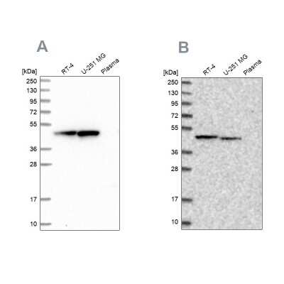 Western Blot: ADE2 Antibody [NBP2-58966] - Analysis using Anti-PAICS antibody NBP2-58966 (A) shows similar pattern to independent antibody NBP1-90235 (B).