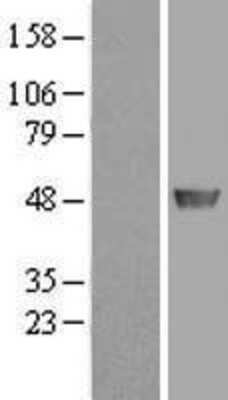 Western Blot: ADE2 Overexpression Lysate (Adult Normal) [NBP2-10636] Left-Empty vector transfected control cell lysate (HEK293 cell lysate); Right -Over-expression Lysate for ADE2.