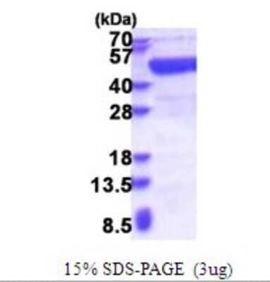 SDS-Page: ADE2 Recombinant Protein [NBP2-51641] - 15% SDS Page (3 ug)