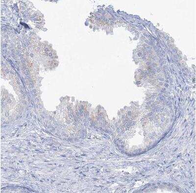 Immunohistochemistry-Paraffin ADGB Antibody