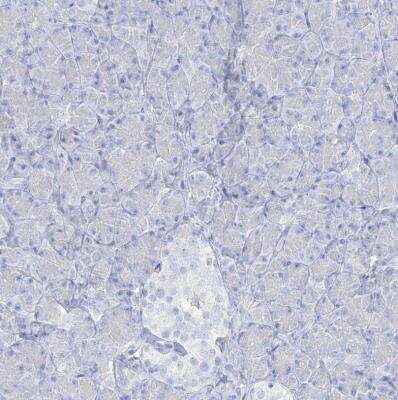 Immunohistochemistry-Paraffin ADGB Antibody