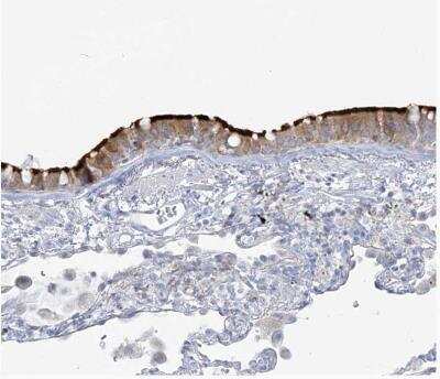 Immunohistochemistry-Paraffin ADGB Antibody