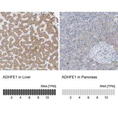 Immunohistochemistry-Paraffin: ADHFE1 Antibody [NBP1-83530] - Staining in human liver and pancreas tissues using anti-ADHFE1 antibody. Corresponding ADHFE1 RNA-seq data are presented for the same tissues.