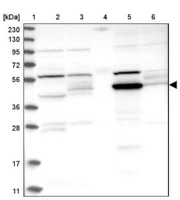 Western Blot: ADHFE1 Antibody [NBP1-83530] - Lane 1: Marker  [kDa] 230, 130, 95, 72, 56, 36, 28, 17, 11.  Lane 2: Human cell line RT-4.  Lane 3: Human cell line U-251MG sp.  Lane 4: Human plasma (IgG/HSA depleted).  Lane 5: Human liver tissue.  Lane 6: Human tonsil tissue