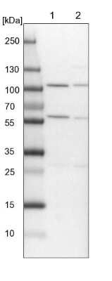 Western Blot: ADHFE1 Antibody [NBP1-83530] - Lane 1: NIH-3T3 cell lysate (Mouse embryonic fibroblast cells). Lane 2: NBT-II cell lysate (Rat Wistar bladder tumor cells).