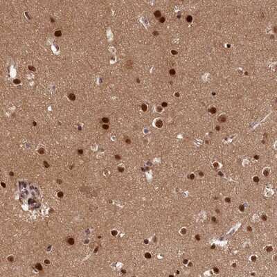 Immunohistochemistry-Paraffin: ADIG Antibody [NBP1-81089] - Staining of human cerebral cortex shows strong nuclear positivity in glial cells.