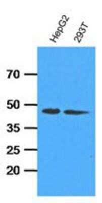 Western Blot: ADK Antibody (4F8) [NBP1-97934] - The cell lysates (35ug) were resolved by SDS-PAGE, transferred to PVDF membrane and probed with anti-human ADK (1:1000). Proteins were visualized using a goat anti-mouse secondary antibody conjugated to HRP and an ECL detection system.