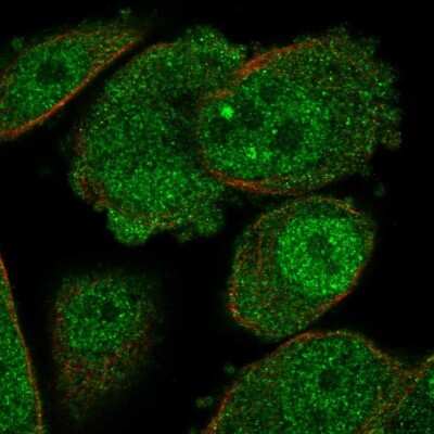 <b>Orthogonal Strategies Validation. </b>Immunocytochemistry/Immunofluorescence: ADK Antibody [NBP1-90197] - Immunofluorescent staining of human cell line PC-3 shows localization to nucleoplasm & cytosol.